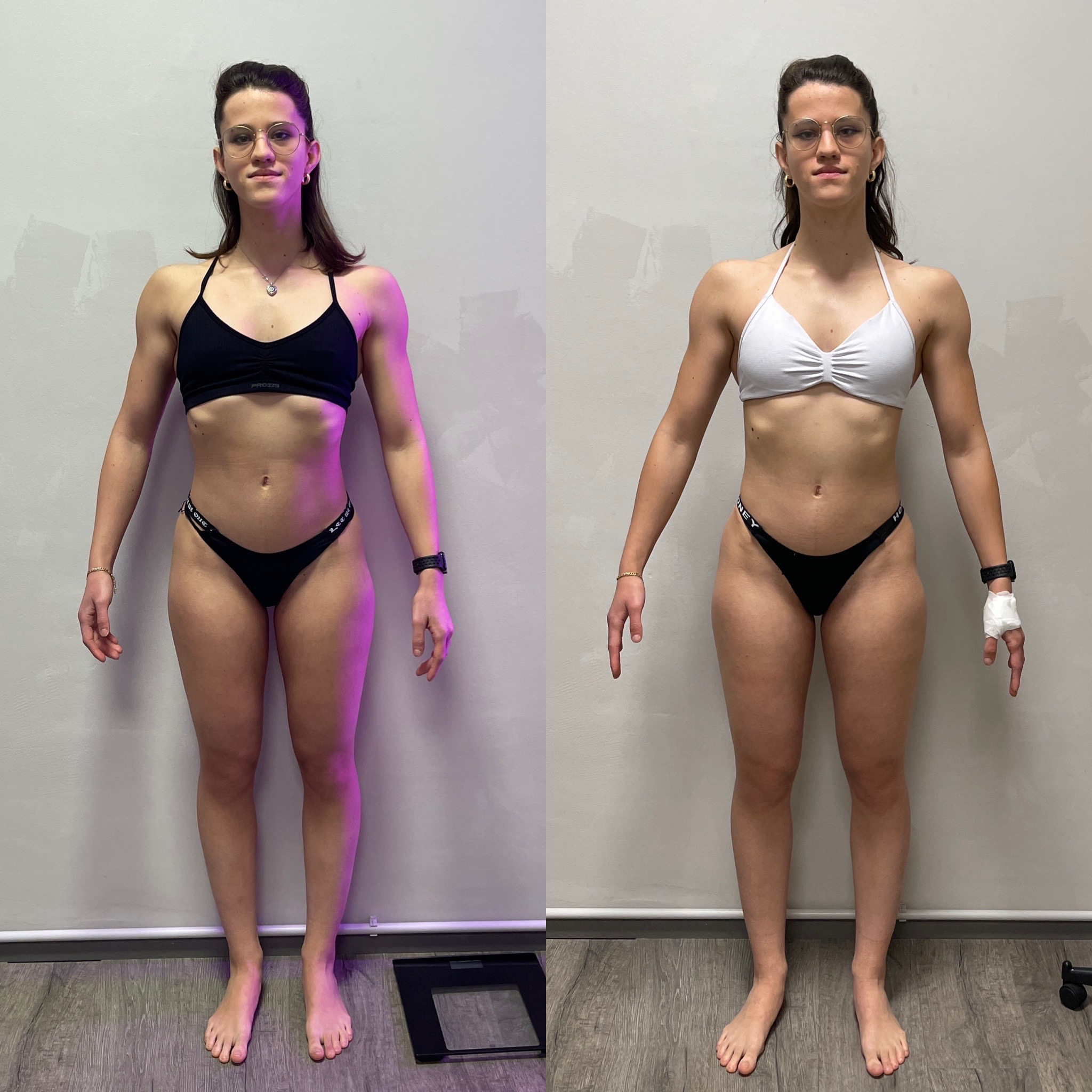 Prima e dopo Pamela vista frontale